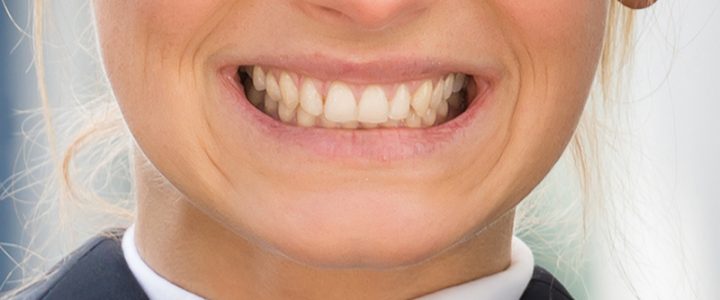 What You Should Know About Teeth Grinding