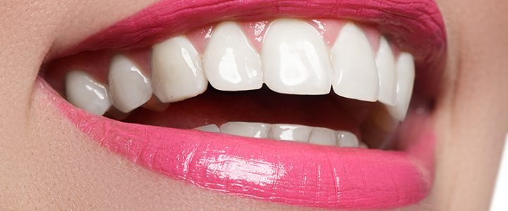 Porcelain Veneers Can Give You a Hollywood Smile